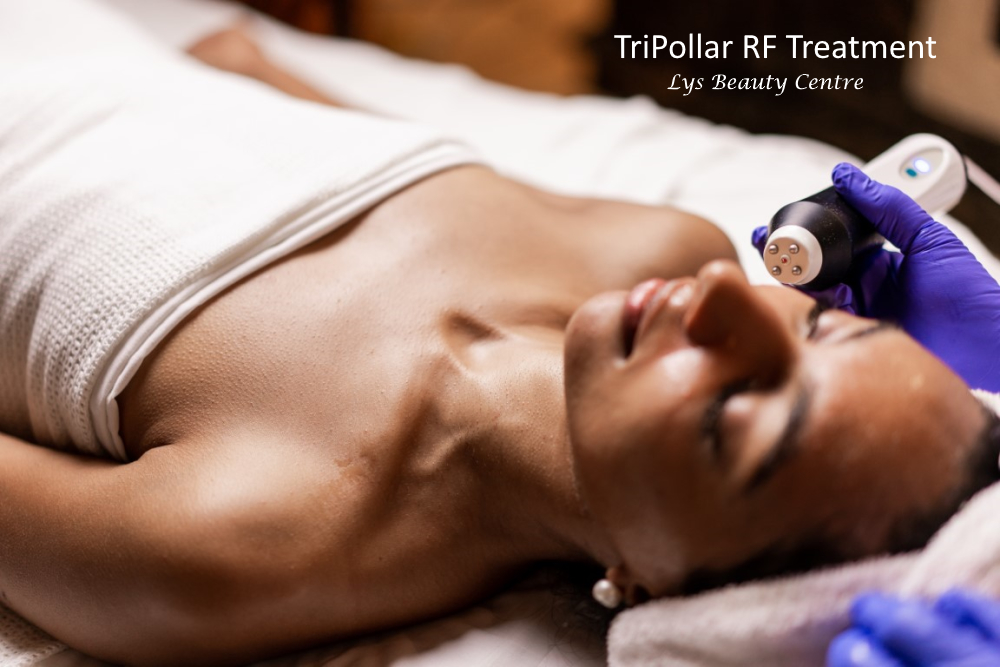 tripollar rf treatment
